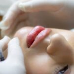 Chirurgie esthétique